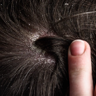 hair rejuvenation therapy